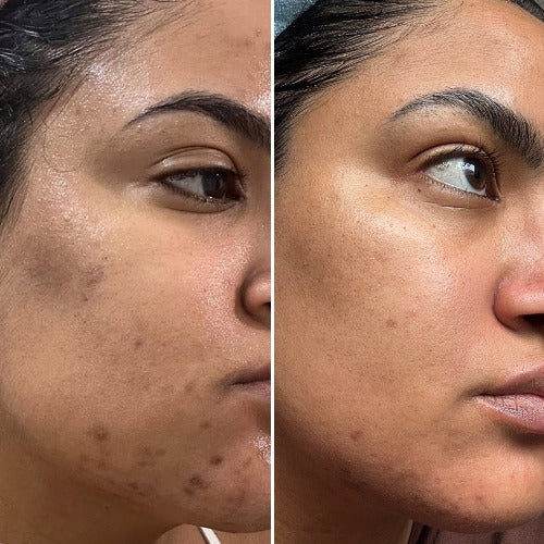 Customer 2: before on the left and after 3–6 months on the right