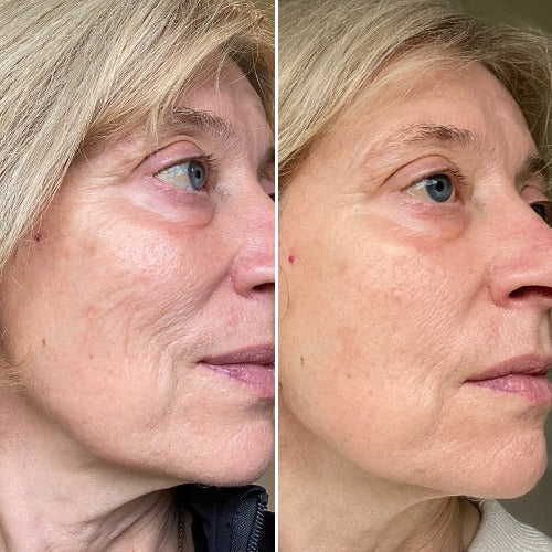 Customer 1: before on the left and after 3–6 months on the right