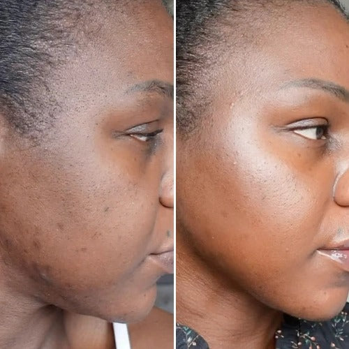 Customer 3: before on the left and after 3–6 months on the right
