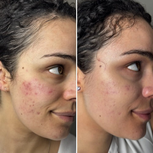 Customer 4: before on the left and after 3–6 months on the right